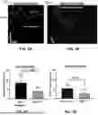 Fig. 04 - MUSCLE PROBE, SYSTEM AND METHOD