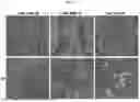 Fig. 03 - COMPOSITION FOR PREVENTING OR TREATING CANCER, AND METHOD FOR PREVENTING OR TREATING CANCER BY USING SAME, HAVING ABSCOPAL EFFECT