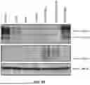 Fig. 08 - TARGETED CHIMERIC ANTIGEN RECEPTOR MODIFIED T CELLS FOR TREATMENT OF IL13Ralpha2 POSITIVE MALIGNANCIES