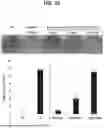 Fig. 20 - NOVEL BACILLUS VELEZENSIS STRAIN PRODUCING MORANOLINE AND USES THEREOF
