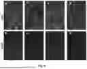 Fig. 06 - ENHANCING NEURONAL DIFFERENTIATION OF VENTRAL MIDBRAIN NEURAL PROGENITOR CELLS