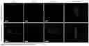 Fig. 06 - 3D Bioprinted Tissues and Screening Assays Therewith