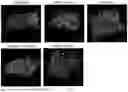 Fig. 07 - 3D Bioprinted Tissues and Screening Assays Therewith