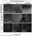 Fig. 06 - COMPOSITIONS AND METHOD FOR THE TREATMENT OF X-LINKED DYSTONIA PARKINSONISM