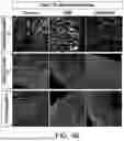 Fig. 07 - COMPOSITIONS AND METHOD FOR THE TREATMENT OF X-LINKED DYSTONIA PARKINSONISM