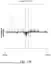 Fig. 22 - COMPOSITIONS AND METHOD FOR THE TREATMENT OF X-LINKED DYSTONIA PARKINSONISM