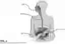 Fig. 02 - APPARATUS, SYSTEMS AND METHODS FOR SOFT TISSUE ABLATION