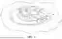 Fig. 02 - METHOD AND ASSEMBLIES FOR REPAIR OF PLASTIC FUEL LOCK RING AND FUEL SUPPLY LINE