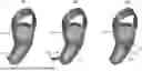 Fig. 01 - Retractable In-Device Strap