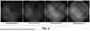 Fig. 03 - SYSTEMS AND METHODS FOR ENHANCING RETINAL COLOR FUNDUS IMAGES FOR RETINOPATHY ANALYSIS