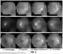 Fig. 04 - SYSTEMS AND METHODS FOR ENHANCING RETINAL COLOR FUNDUS IMAGES FOR RETINOPATHY ANALYSIS