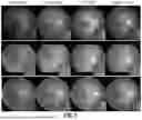 Fig. 06 - SYSTEMS AND METHODS FOR ENHANCING RETINAL COLOR FUNDUS IMAGES FOR RETINOPATHY ANALYSIS