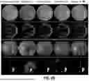 Fig. 08 - SYSTEMS AND METHODS FOR ENHANCING RETINAL COLOR FUNDUS IMAGES FOR RETINOPATHY ANALYSIS