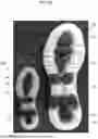 Fig. 04 - FOAMED SOLE COMPONENTS AND METHOD FOR MAKING A SOLE WITH FOAMED SOLE COMPONENTS