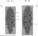 Fig. 09 - FOAMED SOLE COMPONENTS AND METHOD FOR MAKING A SOLE WITH FOAMED SOLE COMPONENTS