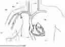Fig. 01 - DEVICES AND METHODS FOR VASCULAR NAVIGATION, ASSESSMENT AND/OR DIAGNOSIS