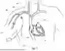 Fig. 02 - DEVICES AND METHODS FOR VASCULAR NAVIGATION, ASSESSMENT AND/OR DIAGNOSIS