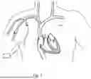 Fig. 03 - DEVICES AND METHODS FOR VASCULAR NAVIGATION, ASSESSMENT AND/OR DIAGNOSIS