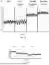 Fig. 09 - DEVICES AND METHODS FOR VASCULAR NAVIGATION, ASSESSMENT AND/OR DIAGNOSIS
