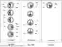 Fig. 35 - DEVICES AND METHODS FOR VASCULAR NAVIGATION, ASSESSMENT AND/OR DIAGNOSIS
