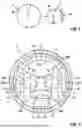 Fig. 03 - SYSTEM AND DEVICE FOR REDUCTION OF VARICOSE VEIN DIAMETER