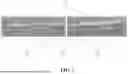 Fig. 02 - METHODS, DEVICES, AND SYSTEMS FOR TREATING BONE DEFECTS