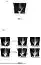 Fig. 08 - CELL-LADEN BIOINK CIRCULATION-ASSISTED INKJET-BASED BIOPRINTING TO MITIGATE CELL SEDIMENTATION AND AGGREGATION