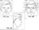 Fig. 07 - FITTING OF HEAD MOUNTED WEARABLE DEVICE FROM TWO-DIMENSIONAL IMAGE