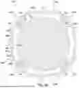 Fig. 09 - RADIALLY EXPANDING SHEATHS