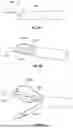 Fig. 09 - Tissue Removal Systems and Methods