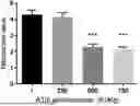 Fig. 01 - ANTITHROMBIN IN STROKE