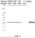 Fig. 05 - KIT OF DETECTING MYCOPLASMA PNEUMONIAE AND METHOD THEREFOR