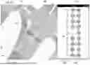 Fig. 10 - HANDLING LANE CLOSURES