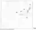 Fig. 11 - DEVICE FOR CHEST WALL RECONSTRUCTION