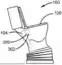 Fig. 01 - Adjustable Toilet Device