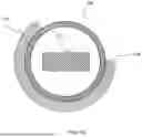 Fig. 10 - ENDOVASCULAR DEVICE