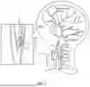 Fig. 02 - APPARATUSES AND METHODS FOR DIRECT CAROTID INTERVENTION