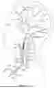 Fig. 05 - APPARATUSES AND METHODS FOR DIRECT CAROTID INTERVENTION
