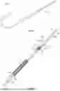 Fig. 07 - APPARATUSES AND METHODS FOR DIRECT CAROTID INTERVENTION