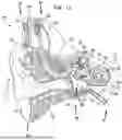 Fig. 02 - IMPLANTABLE STIMULATING ASSEMBLY