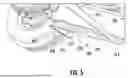 Fig. 07 - Parking Brake for Towable Trailer and Method of Using Same