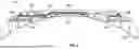 Fig. 05 - HOPPER RAILROAD CAR HAVING MULTI-LEVEL RUNNING BOARDS