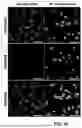 Fig. 06 - POLYPEPTIDES SELF-ASSEMBLING INTO NANOPARTICLES