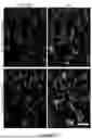 Fig. 40 - COMPOSITIONS AND METHODS FOR MICROGLIA REPLACEMENT THERAPY