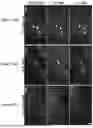Fig. 44 - COMPOSITIONS AND METHODS FOR MICROGLIA REPLACEMENT THERAPY