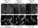 Fig. 46 - COMPOSITIONS AND METHODS FOR MICROGLIA REPLACEMENT THERAPY