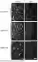Fig. 50 - COMPOSITIONS AND METHODS FOR MICROGLIA REPLACEMENT THERAPY