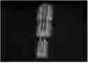 Fig. 01 - Heart Murmur Visualization and Analysis