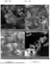 Fig. 06 - NANOSYSTEMS BASED ON NANOCOMPOSITES AND NATURAL EXTRACTS