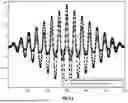 Fig. 09 - DETECTION OF GAIT ACTIVITY